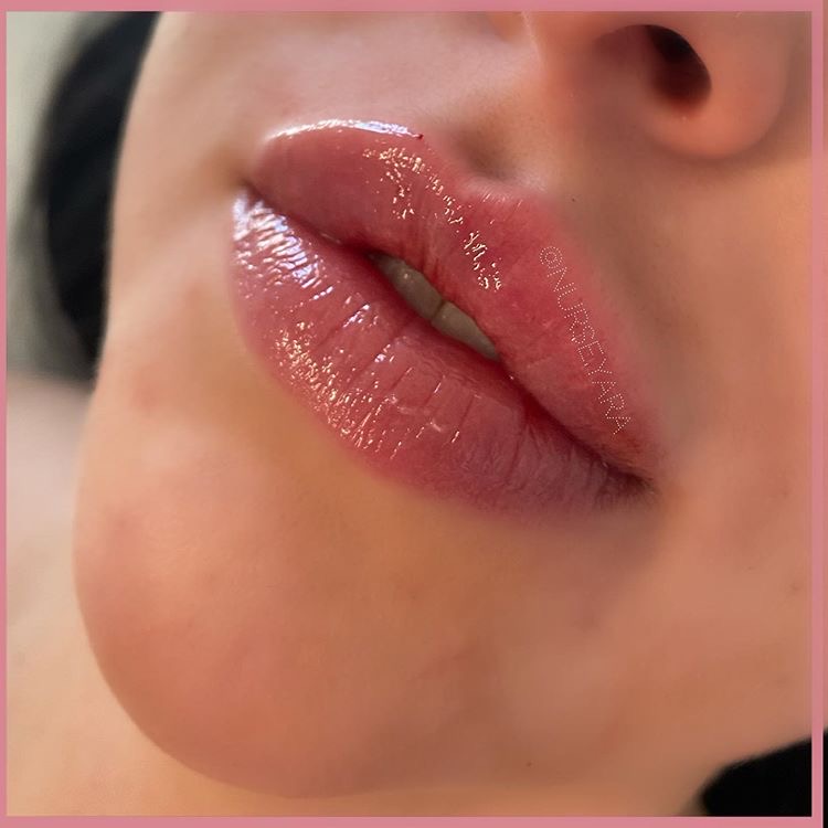 Nurse Yara gallery